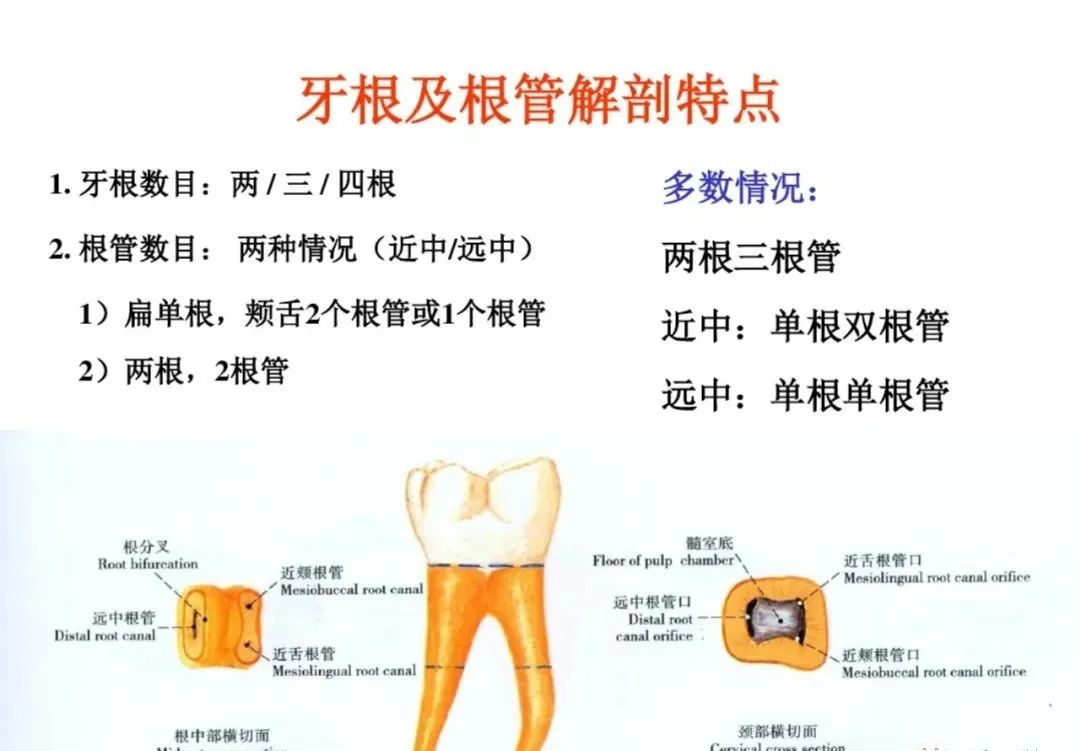 盘点磨牙开髓的方法