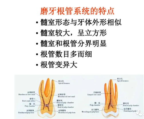 盘点磨牙开髓的方法