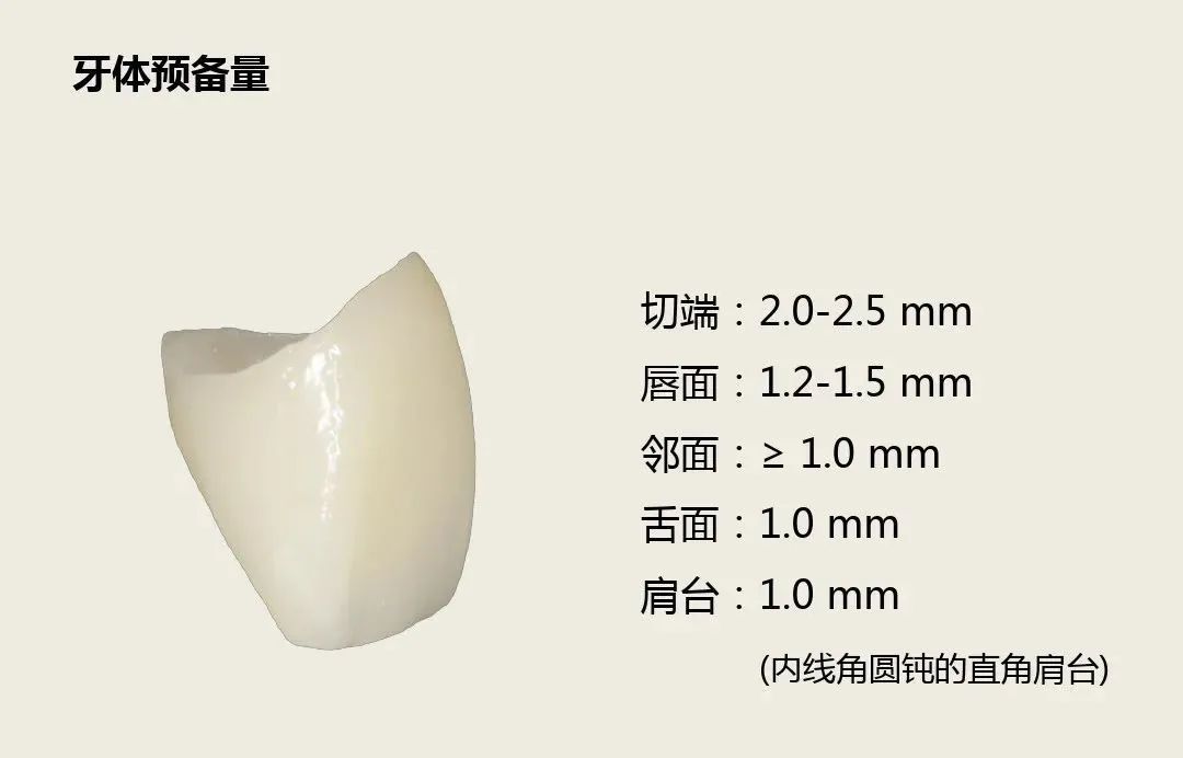 前牙全瓷冠的牙体预备