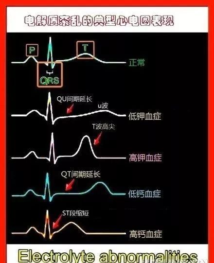 图解心血管系统知识点，绝对让你看过瘾！