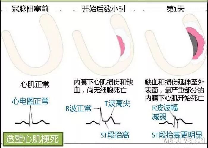 图解心血管系统知识点，绝对让你看过瘾！