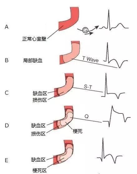 图解心血管系统知识点，绝对让你看过瘾！