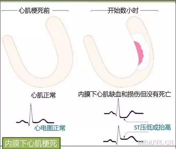 图解心血管系统知识点，绝对让你看过瘾！