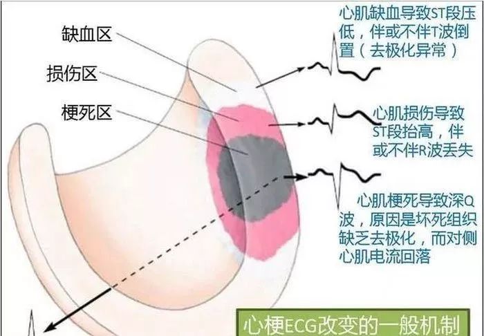 图解心血管系统知识点，绝对让你看过瘾！