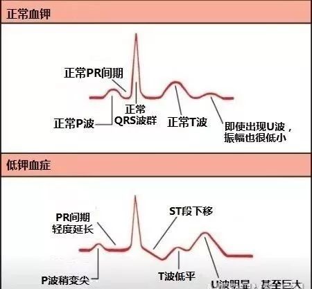 图解心血管系统知识点，绝对让你看过瘾！