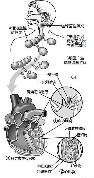 图解心血管系统知识点，绝对让你看过瘾！