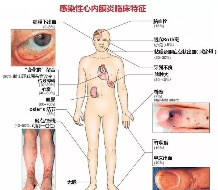 图解心血管系统知识点，绝对让你看过瘾！