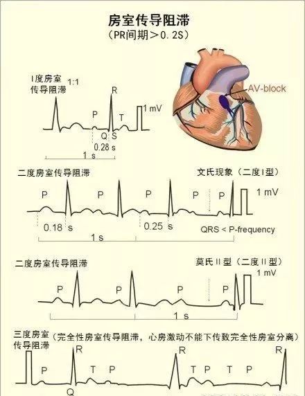 图解心血管系统知识点，绝对让你看过瘾！