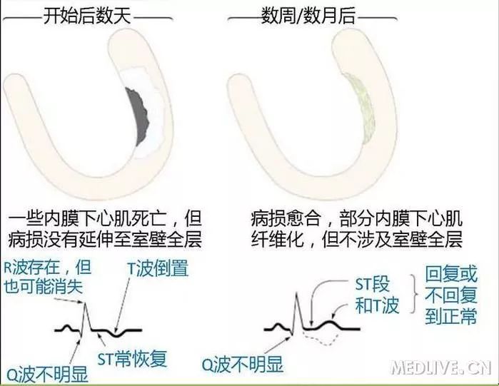 图解心血管系统知识点，绝对让你看过瘾！