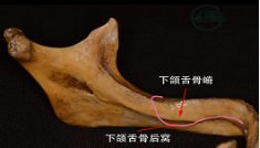 全口义齿无牙颌解剖标志和功能分区详解