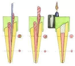 关于根管治疗水平提升的操作细节