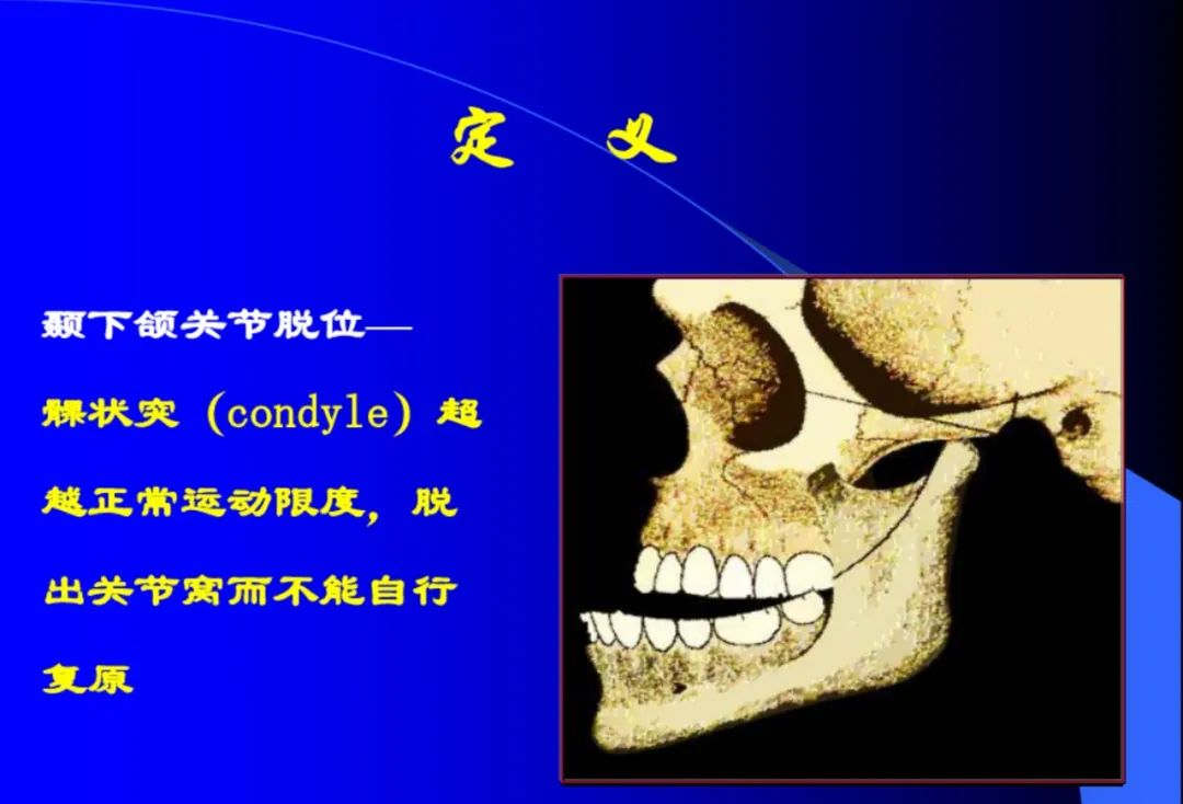 口腔颌面外科学：颞下颌关节脱位