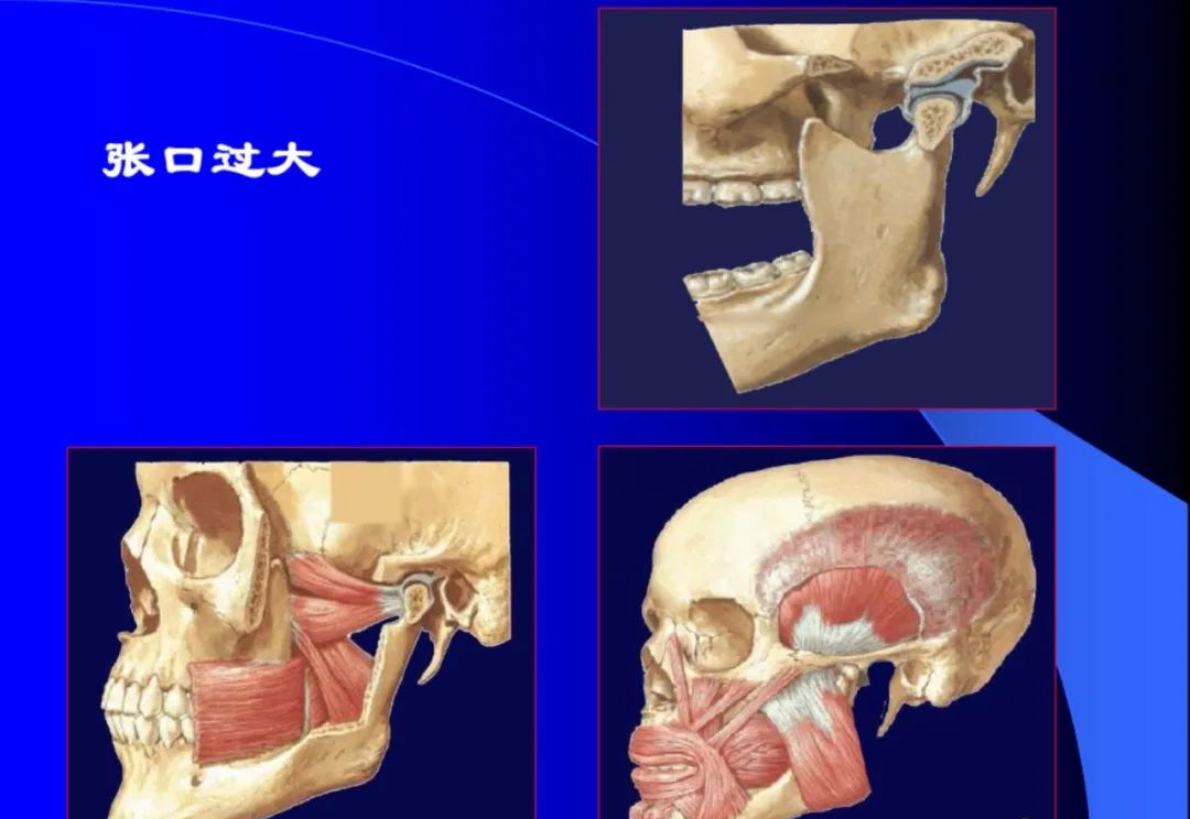 口腔颌面外科学：颞下颌关节脱位