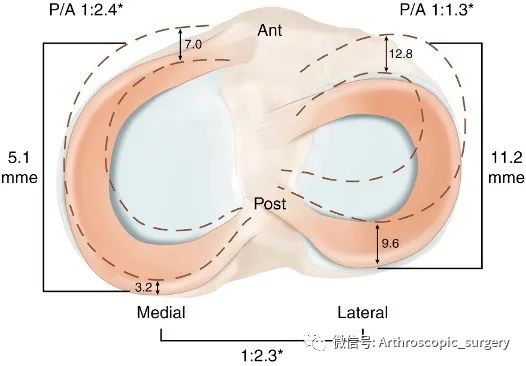 【手术技术】完美外侧半月板前角是如何练成的？