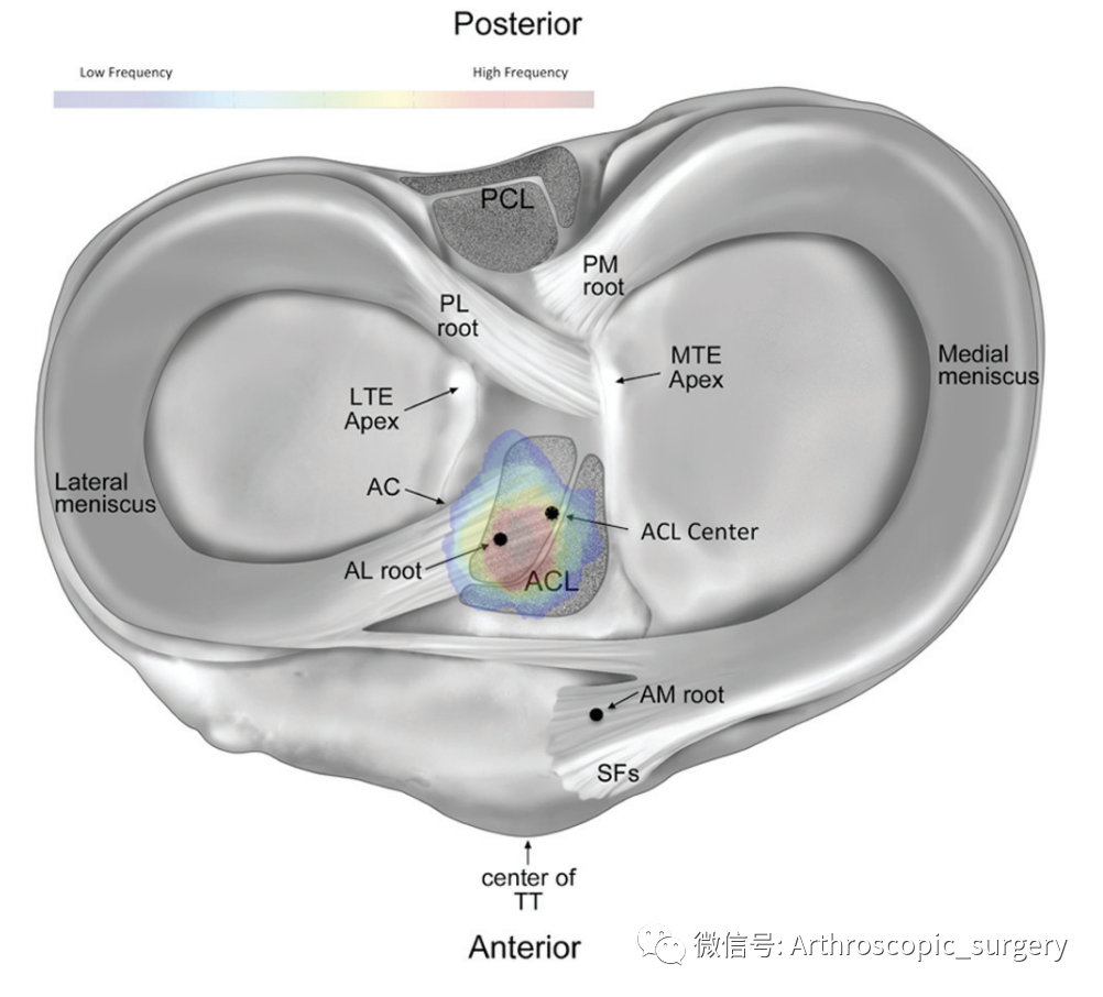 【手术技术】完美外侧半月板前角是如何练成的？