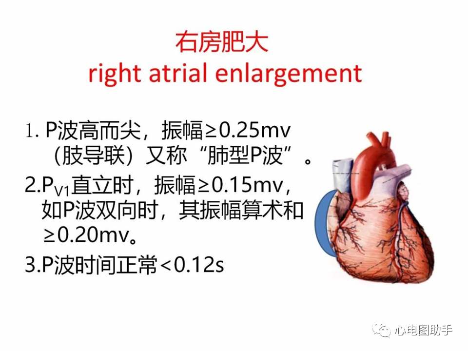心脏解剖与心电图