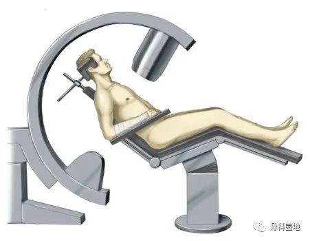 【手术技巧】一文介绍肱骨干骨折顺行、逆行髓内钉手术方法及注意事项