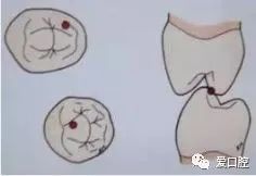 牙医必须掌握的咬合分析