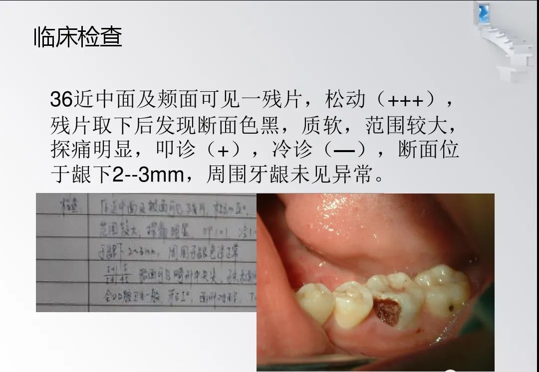 龈切术与冠延长术