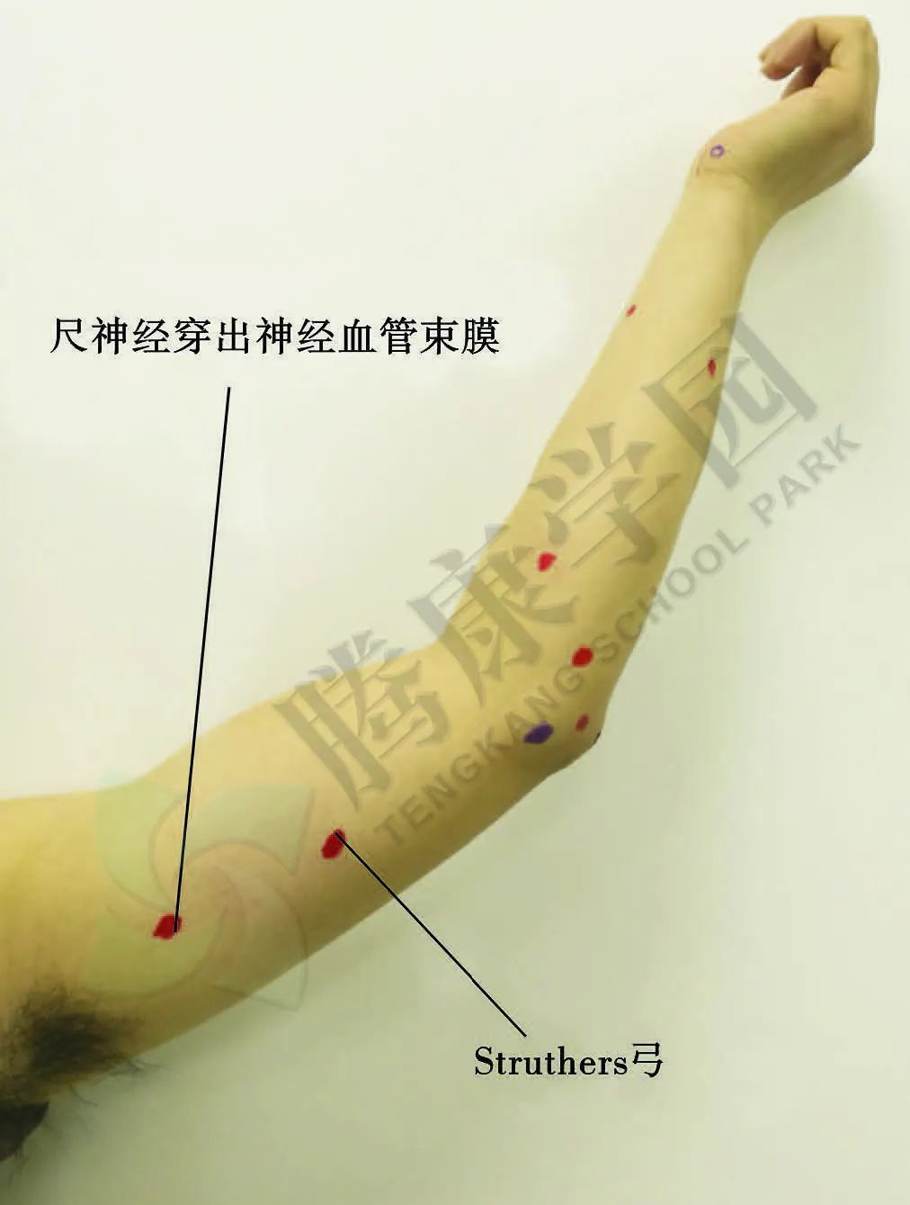 从肘管综合征到肩颈疼痛，他们是怎么联系在一起的？