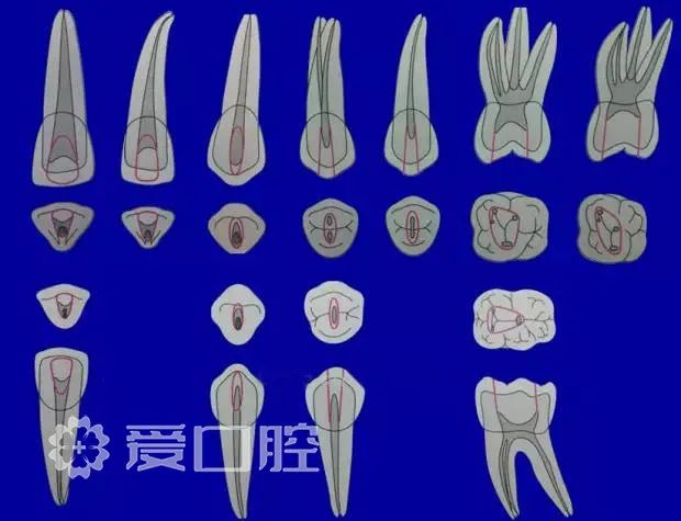 根管治疗应该注意的细节总结