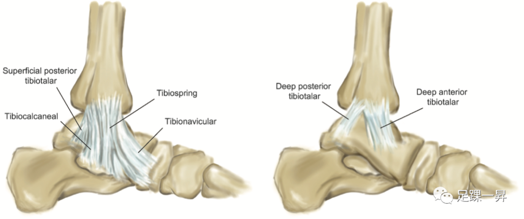 踝关节骨折：三角韧带损伤对Weber