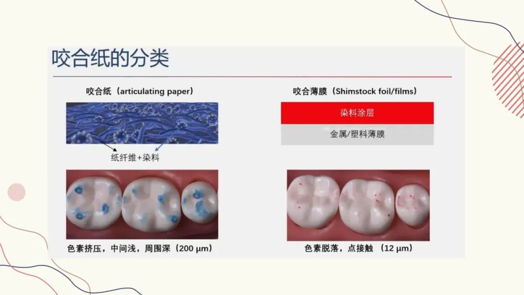 咬合纸的临床应用