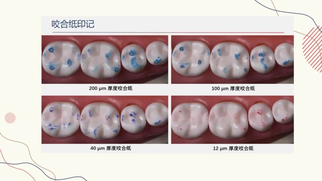 咬合纸的临床应用