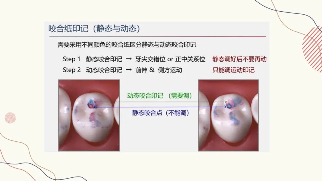 咬合纸的临床应用