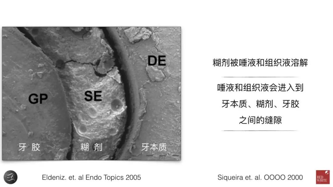 三种根充材料临床使用效果对比，你常用的是哪种？