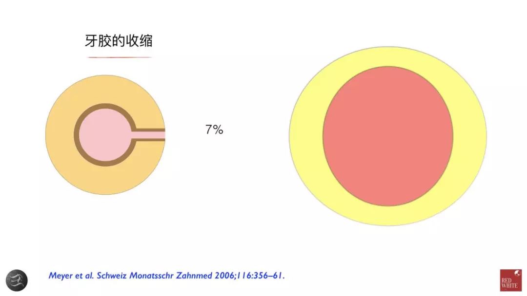 三种根充材料临床使用效果对比，你常用的是哪种？