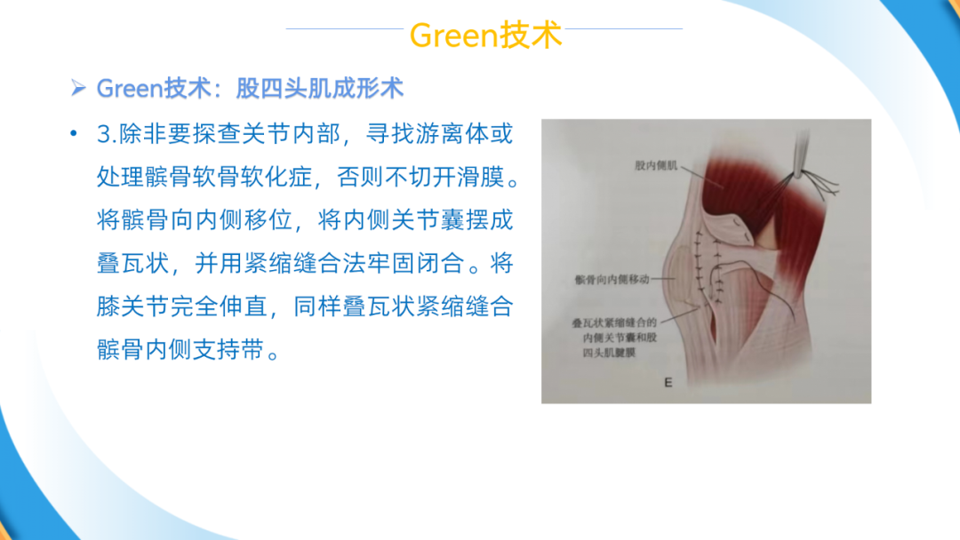 股四头肌成形术（Green术）治疗儿童先天性/习惯性髌骨脱位