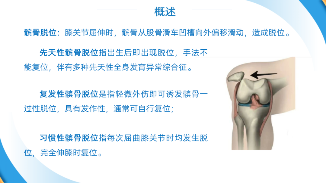 股四头肌成形术（Green术）治疗儿童先天性/习惯性髌骨脱位