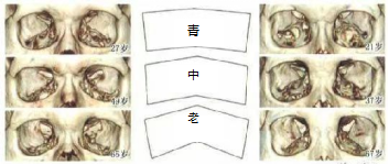 眶骨变化对眼周外貌影响的底层逻辑