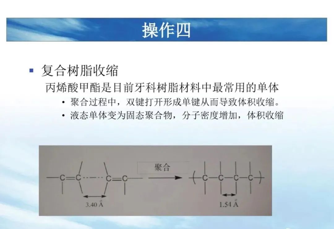 树脂充填后敏感的原因分析！