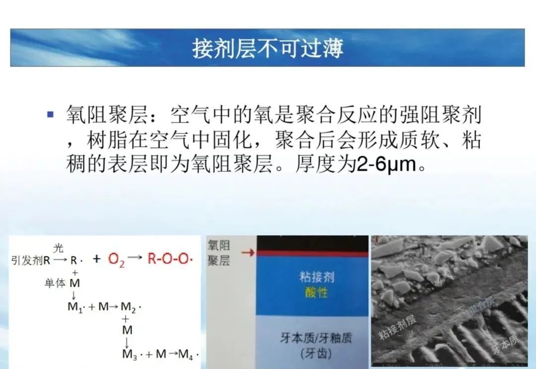 树脂充填后敏感的原因分析！