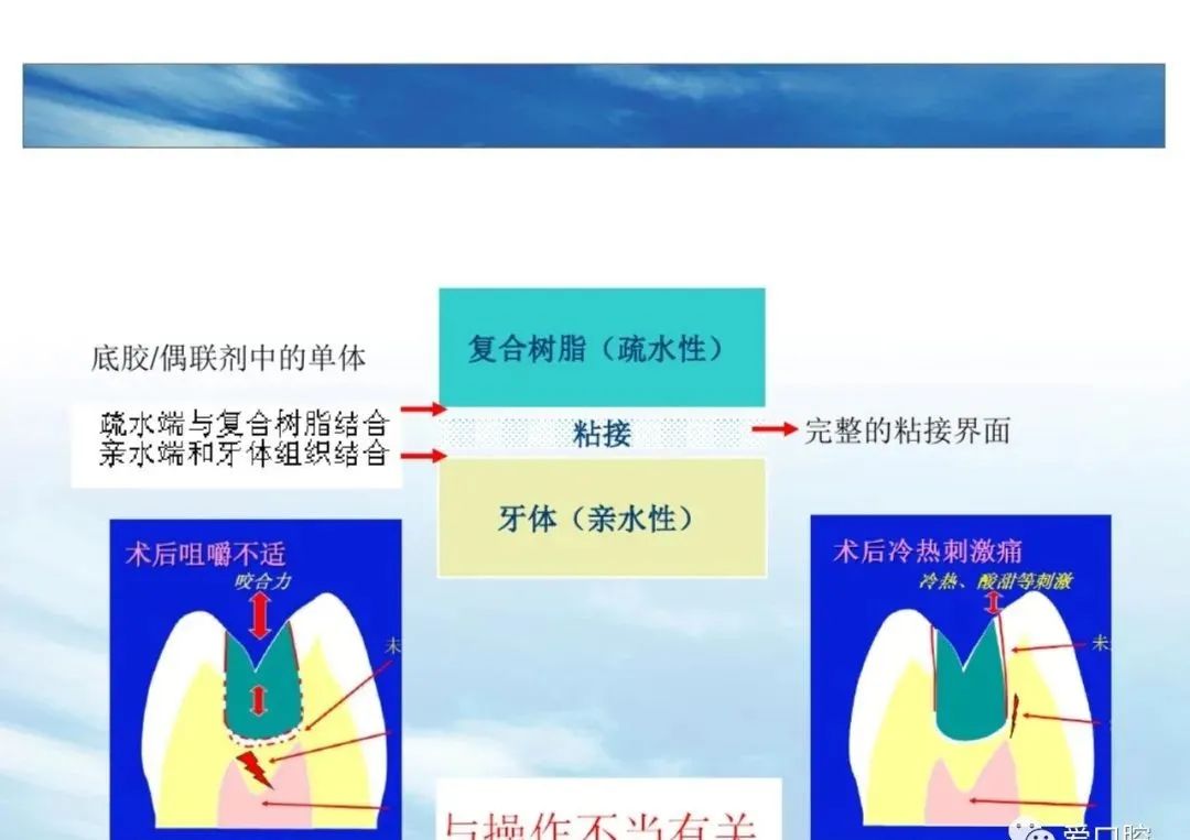 树脂充填后敏感的原因分析！