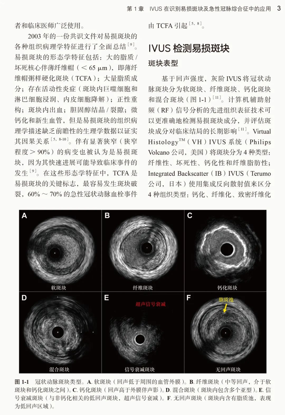 新书推荐：冠状动脉腔内影像学研究进展及应用