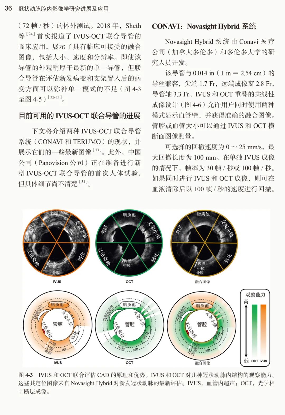 新书推荐：冠状动脉腔内影像学研究进展及应用