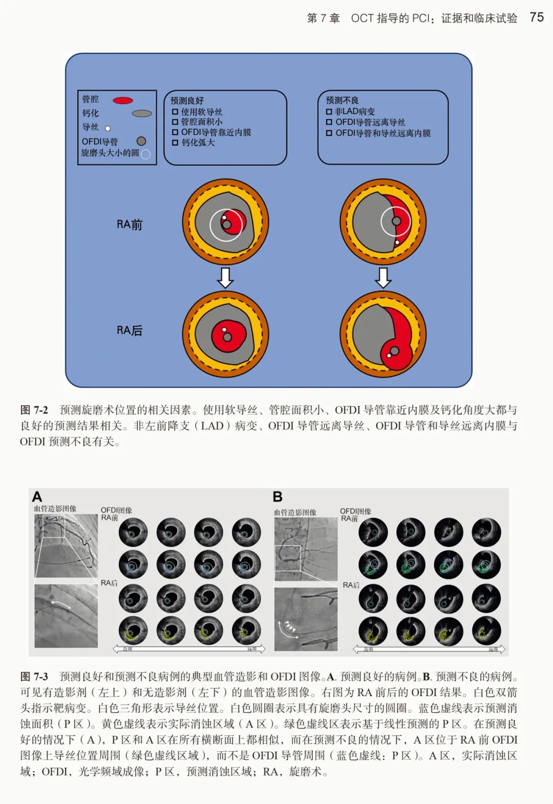 新书推荐：冠状动脉腔内影像学研究进展及应用