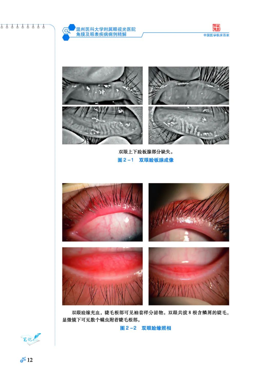 畅销书丨温州医科大学附属眼视光医院