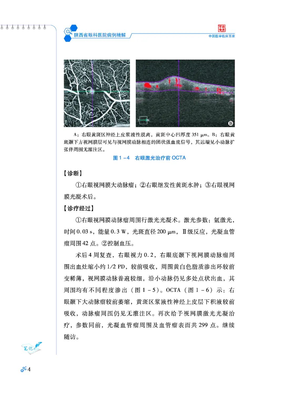 好书推荐：陕西省眼科医院病例精解