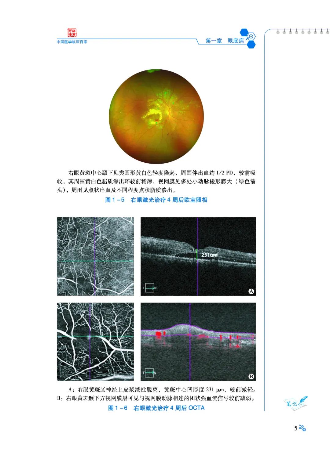 好书推荐：陕西省眼科医院病例精解