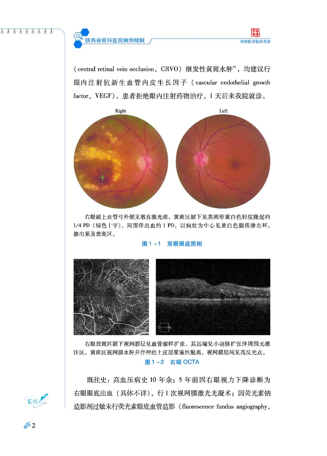 好书推荐：陕西省眼科医院病例精解