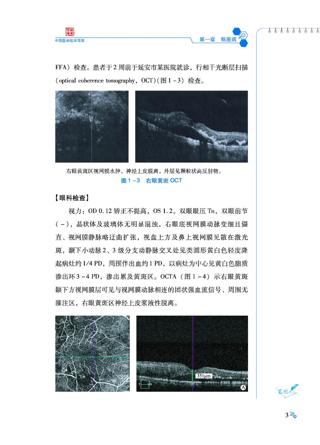 好书推荐：陕西省眼科医院病例精解