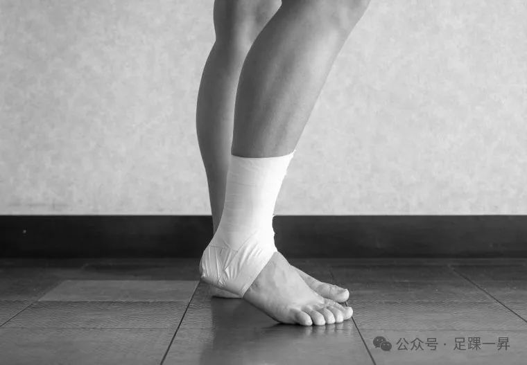 【足踝查体】低位及高位踝关节扭伤