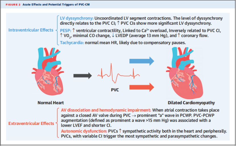 【JACC综述】心律失常导致的心肌病，有三大类！