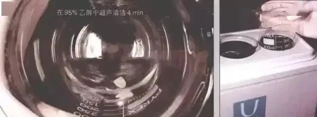 贴面粘接，有4点需要特殊强调