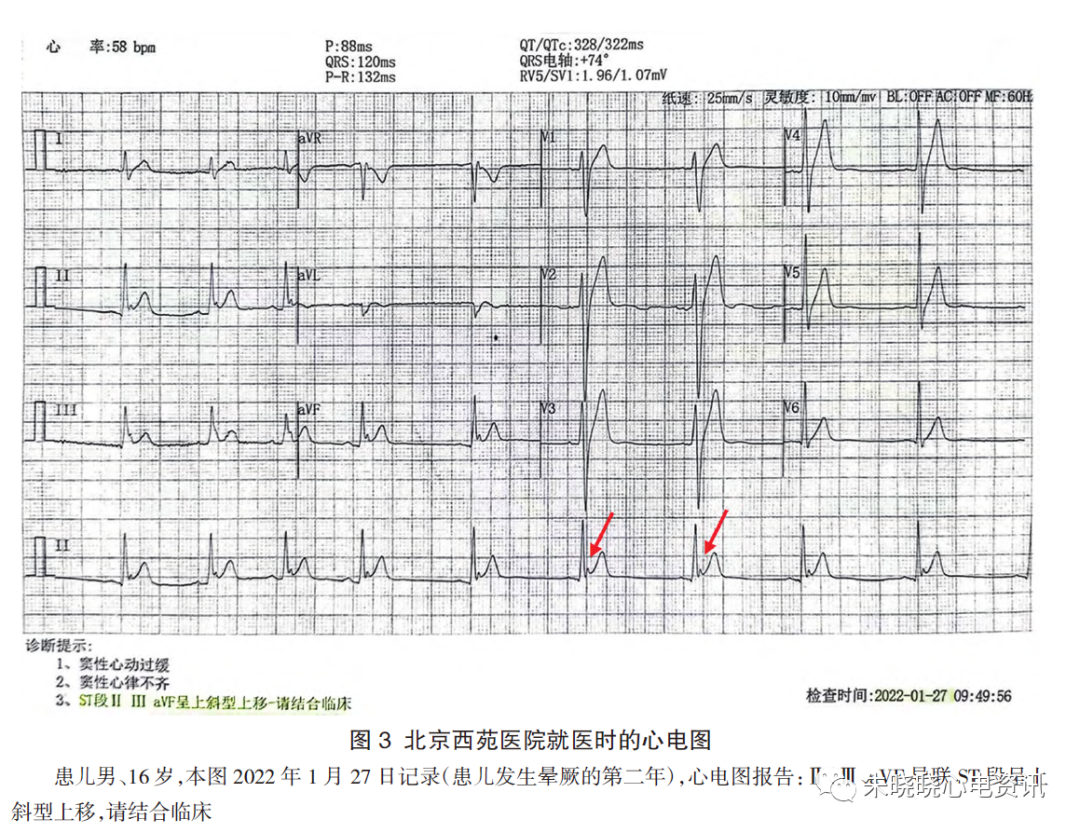 反复就医五年，为何不能阻挡死神的降临