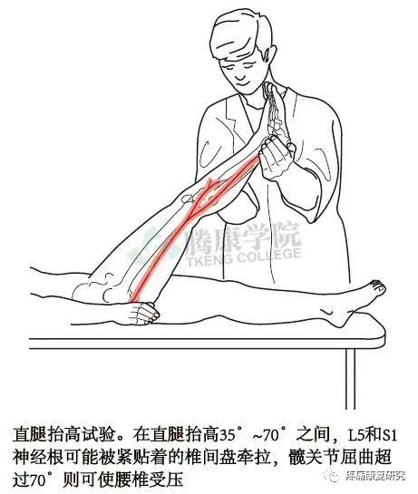 腰椎滑脱的分型、病因、诊断和治疗及锻炼